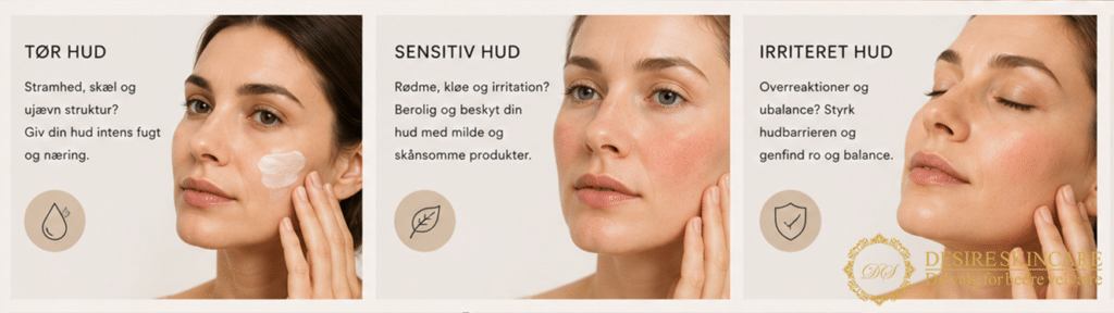Desireskincare_Hudpleje_Hudproblemer_Hudbehandling_Banner2-1